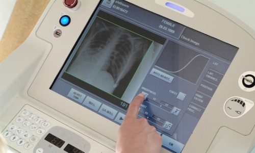 Экран палатного рентгеновского аппарата